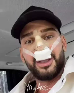 Dorian Popa, detalii despre operația de la nas: intervenția a durat șase ore și jumătate