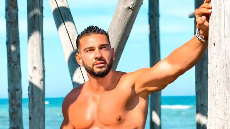 Dorian Popa vorbește despre recuperarea după operația la nas: „Fața își revine încet, nu vă speriați!”