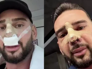 Dorian Popa vorbește despre recuperarea după operația la nas: „Fața își revine încet, nu vă speriați!”