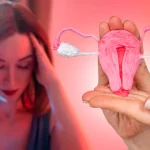 Endometrioza și riscul de cancer ovarian. Simptomele care ar trebui să te trimită la medic